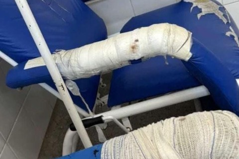 Retratos do Descaso: Cadeira Remendada com Ataduras Simboliza Crise na Saúde de São Cristóvão